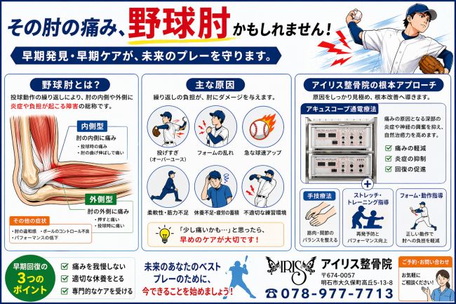 明石市大久保 野球肘 の原因と改善法を解説するインフォグラフィック。投球時の痛みやアキュスコープ通電療法について。