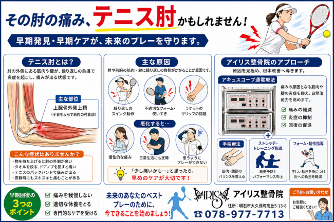 明石市大久保 テニス肘 の解説画像。症状（物を持つ・タオルを絞る時の痛み）、原因（使いすぎ・フォーム不良）、アキュスコープ通電療法などの治療法を紹介。