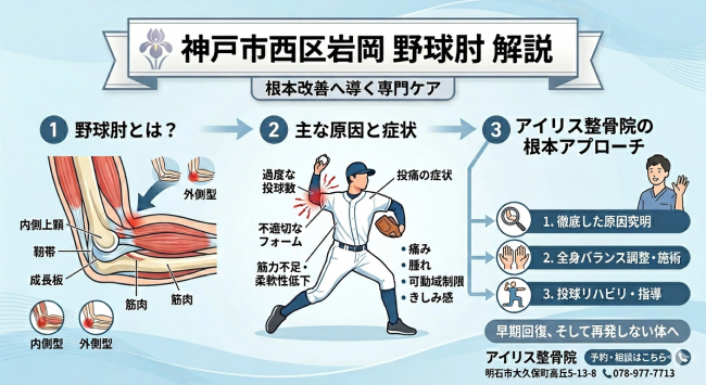  神戸市西区岩岡町 野球肘 解説。内側型・外側型の違い、原因、アイリス整骨院の根本アプローチ（原因究明・全身調整・投球リハビリ）をまとめたインフォグラフィック画像。