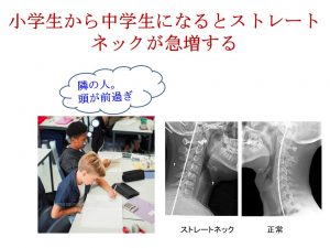 明石市 小中学生 ストレートネック の急増を解説する比較画像。勉強中の姿勢とレントゲン図解