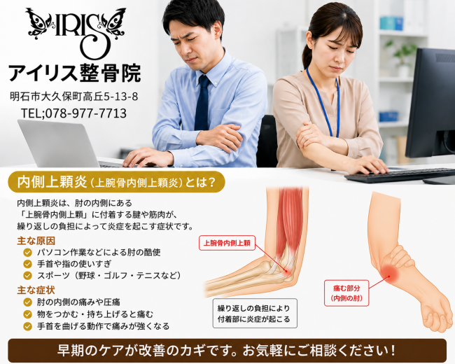 明石市大久保 内側上顆炎放置しないで治療・根本改善を目指すアイリス整骨院。デスクワークのタイピングで肘の内側が痛む男女の写真。
